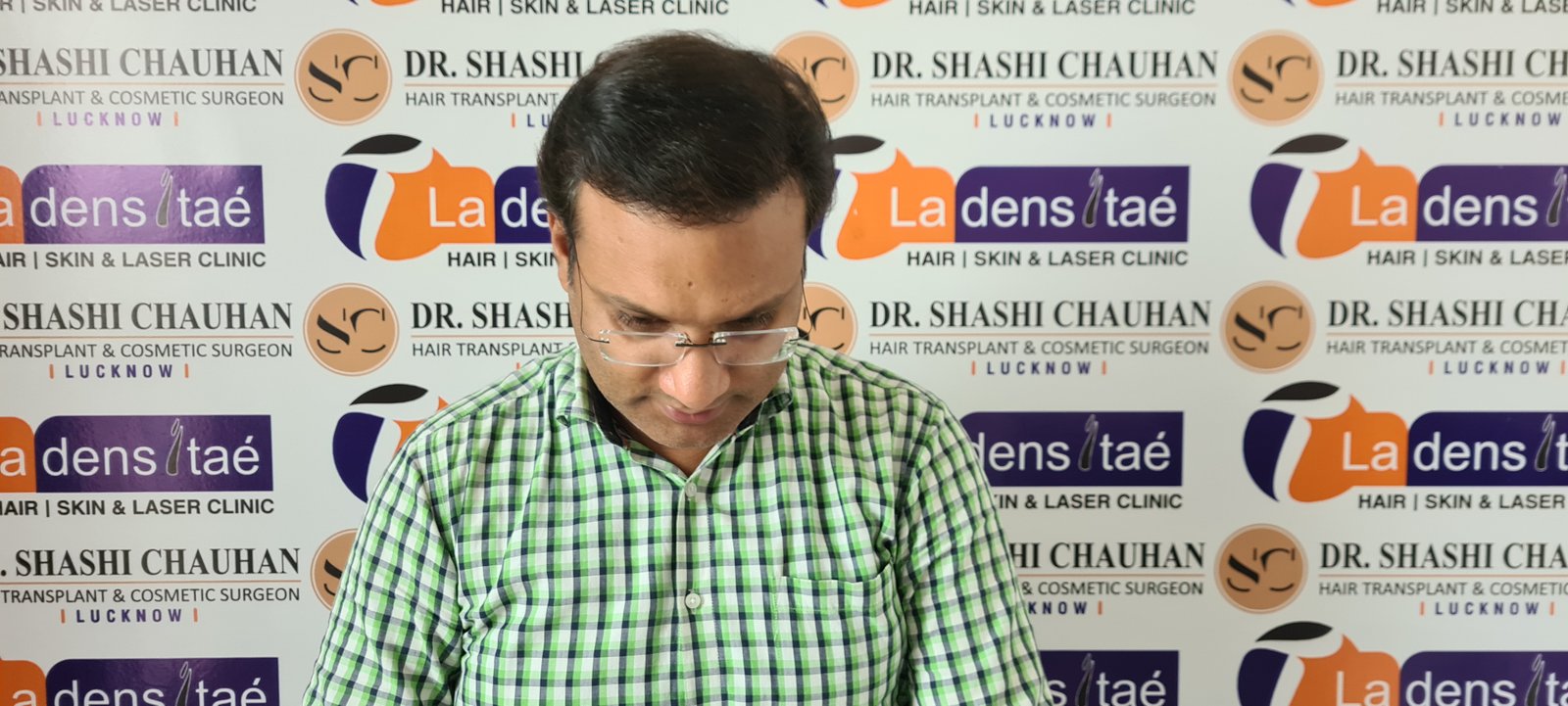 Rahul Agrawal After Hair Transplant
